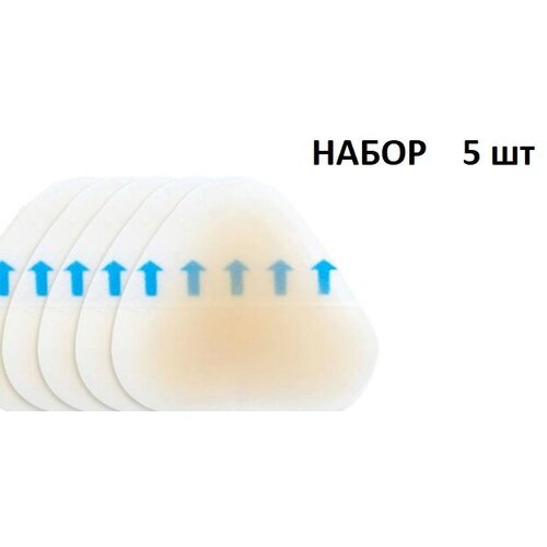 ������ ������ �������� ��������� 42�45 ��, ��������������� �������, 5 �� ����